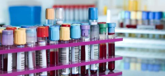 Fiolki z próbkami krwi pacjentów, przeznaczone m.in. do morfologii krwi i oceny stężenia monocytów.