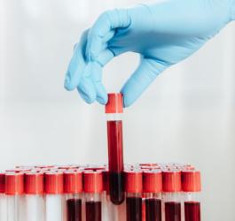 Morfologia – podstawowe badanie krwi