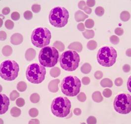 Neutrofile widoczne pod mikroskopem.