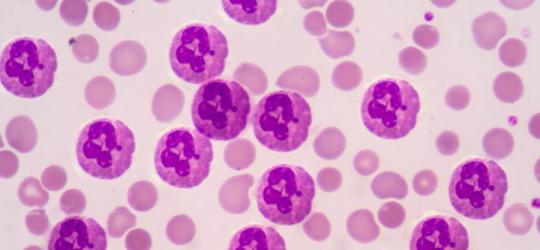 Neutrofile widoczne pod mikroskopem.