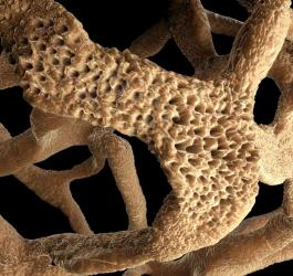 osteoporoza struktura kości