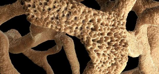 osteoporoza struktura kości
