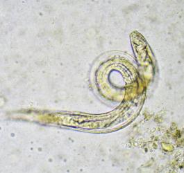 Owsik ludzki widoczny pod mikroskopem.