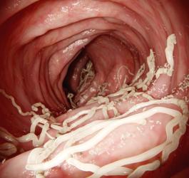 Pasożyt obecny w ludzkim przewodzie pokarmowym.