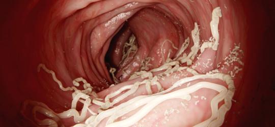 Pasożyt obecny w ludzkim przewodzie pokarmowym.