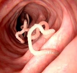 Pasożyt ludzki w świetle jelita cienkiego.