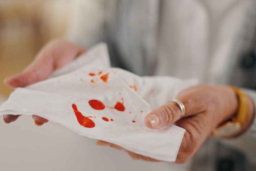 Kobieta zmaga się z krwiopluciem, widzi krew na chusteczce higienicznej.