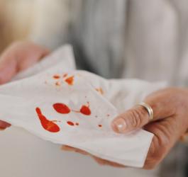 Kobieta zmaga się z krwiopluciem, widzi krew na chusteczce higienicznej.