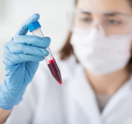 Podwyższone leukocyty, leukocyty w moczu - co oznaczają?