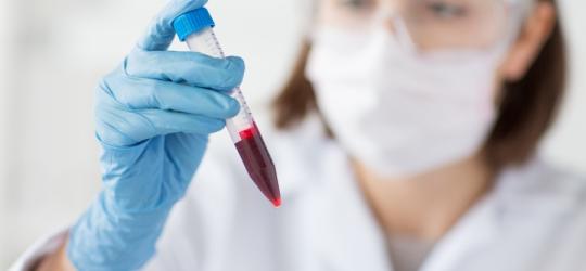 Podwyższone leukocyty, leukocyty w moczu - co oznaczają?