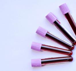 Próbki krwi na fioletowym tle.