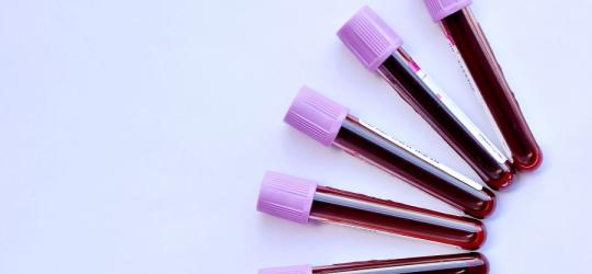 Próbki krwi na fioletowym tle.