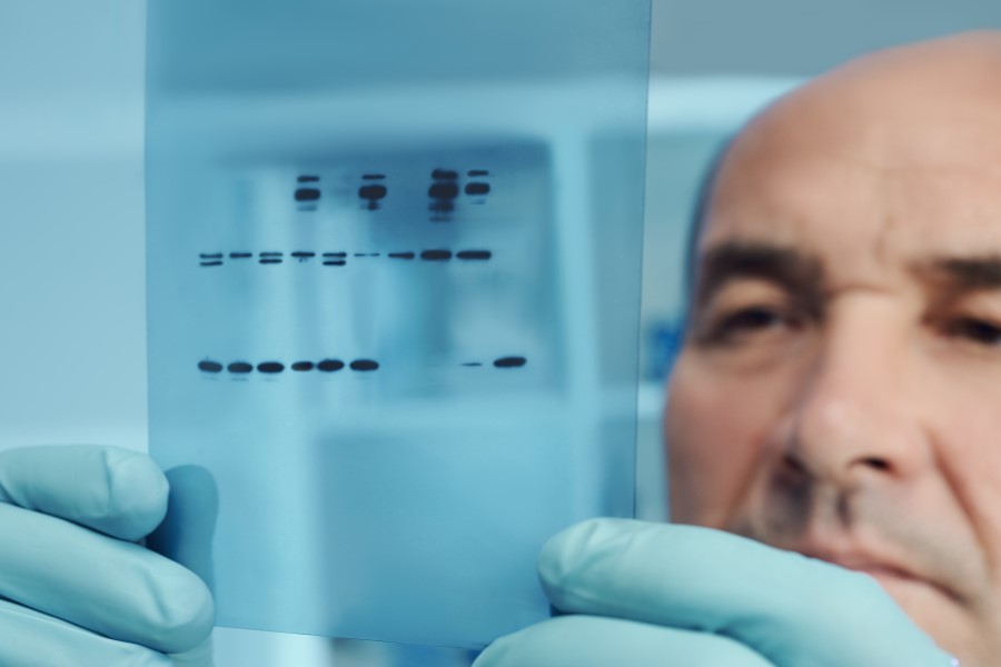 Diagnosta przygląda się wynikom proteinogramu.