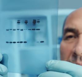 Diagnosta przygląda się wynikom proteinogramu.