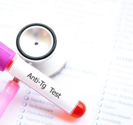 Fiolka z próbką krwi do badań przeciwciał anty-TG, leżąca na stetoskopie i kartką z wykazem badań.