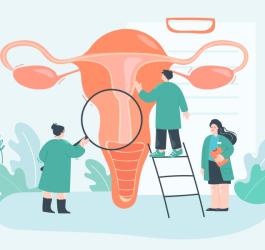 Rysunkowi lekarze prowadzą diagnostykę pod kątem raka szyjki macicy.