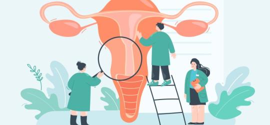 Rysunkowi lekarze prowadzą diagnostykę pod kątem raka szyjki macicy.