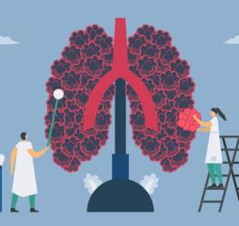 Grafika 2D ludzkich płuc z objawami rozedmy płuc.