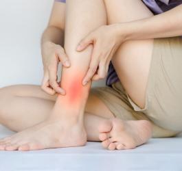 Kobieta trzyma się za łydkę, dokucza jej rumień guzowaty.