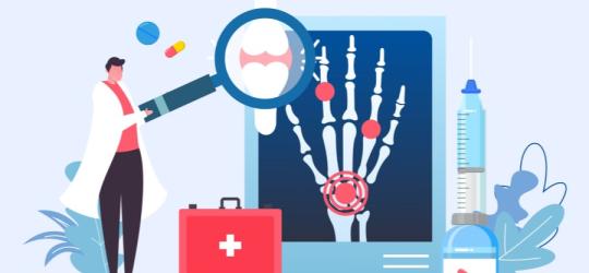 Rysunkowy lekarz diagnozuje RZS.