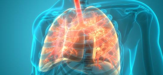 Sarkoidoza - objawy i leczenie