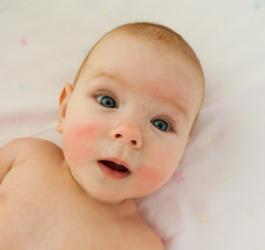 Skaza białkowa – objawy i leczenie