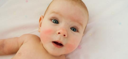 Skaza białkowa – objawy i leczenie