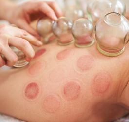 Mężczyzna ma stawiane bańki ogniowe.