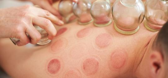 Mężczyzna ma stawiane bańki ogniowe.