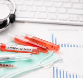 Testy serologiczne niewskazane w diagnostyce SARS-CoV-2