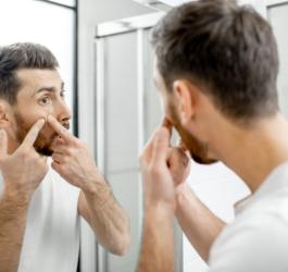 Mężczyzna wyciska pryszcza przed lustrem. Dokucza mu trądzik pospolity.