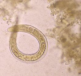 Larwa węgorka jelitowego pod mikroskopem.