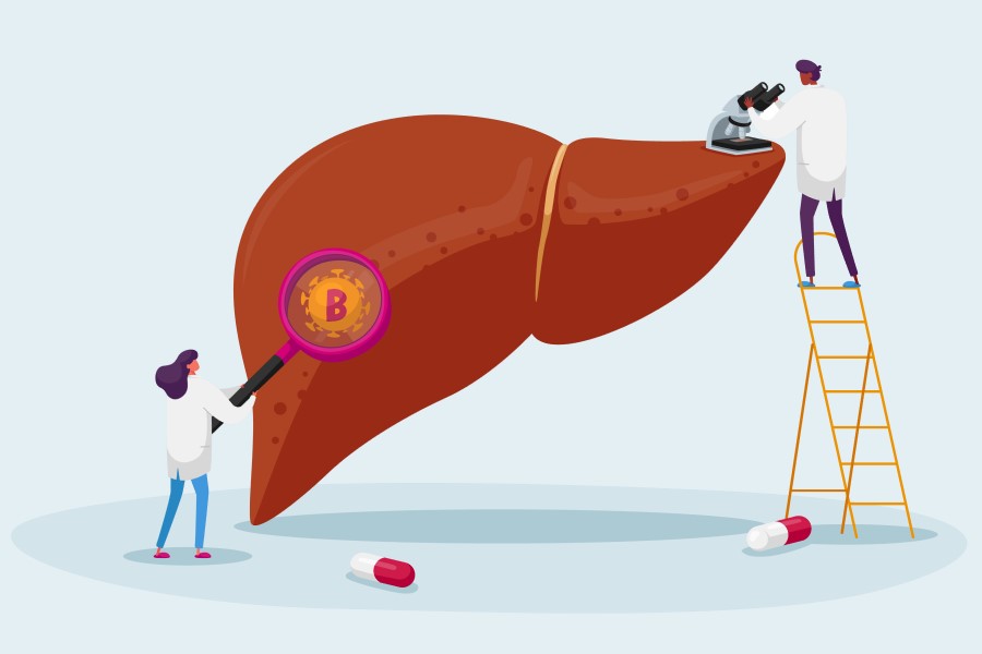 Rysunkowi lekarze diagnozują wątrobę w kierunku WZW typu B.