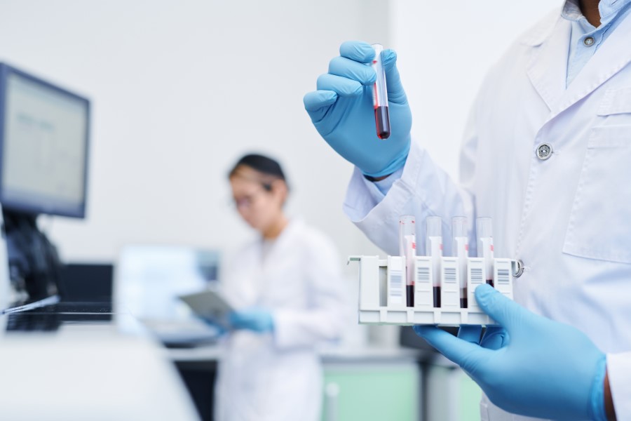 Diagności w laboratorium. Jeden z nich trzyma w ręce próbówki z krwią przeznaczoną do badań.