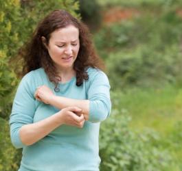 Kobieta ze swędzącą wysypką alergiczną na ręce.