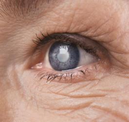 Zaćma - objawy i sposoby usuwania katarakty