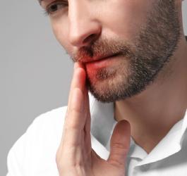 Mężczyzna dotyka kącika ust, który jest zaczerwieniony z powodu zapalenia kącików ust, czyli zajadów
